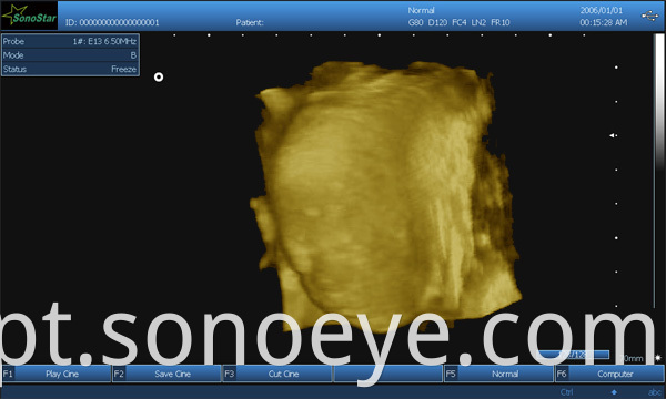 image for labtop ultrasound